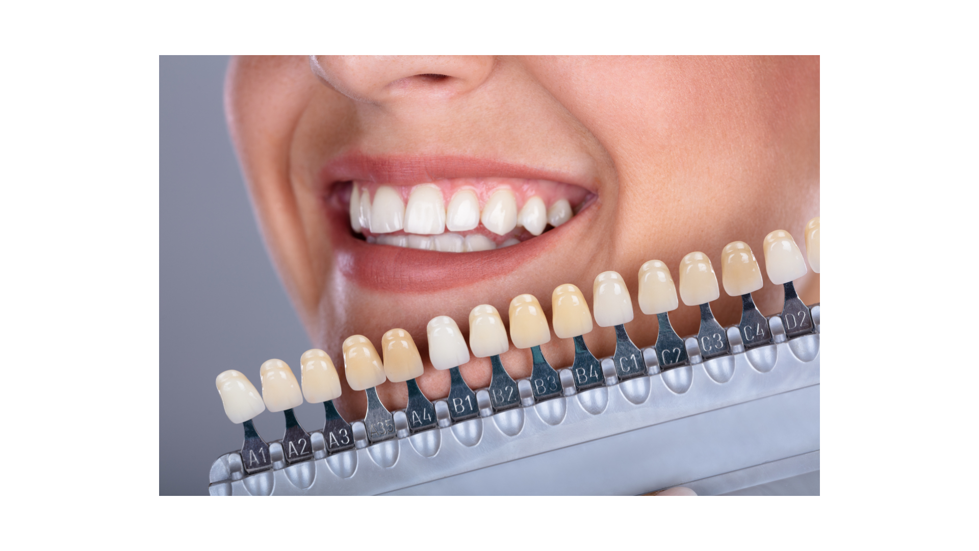 dentiste